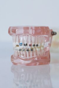 Read more about the article Orthodontic Dentistry: Fundamentals and Techniques